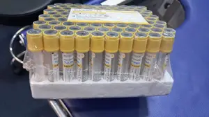 Yellow Vacuutainers