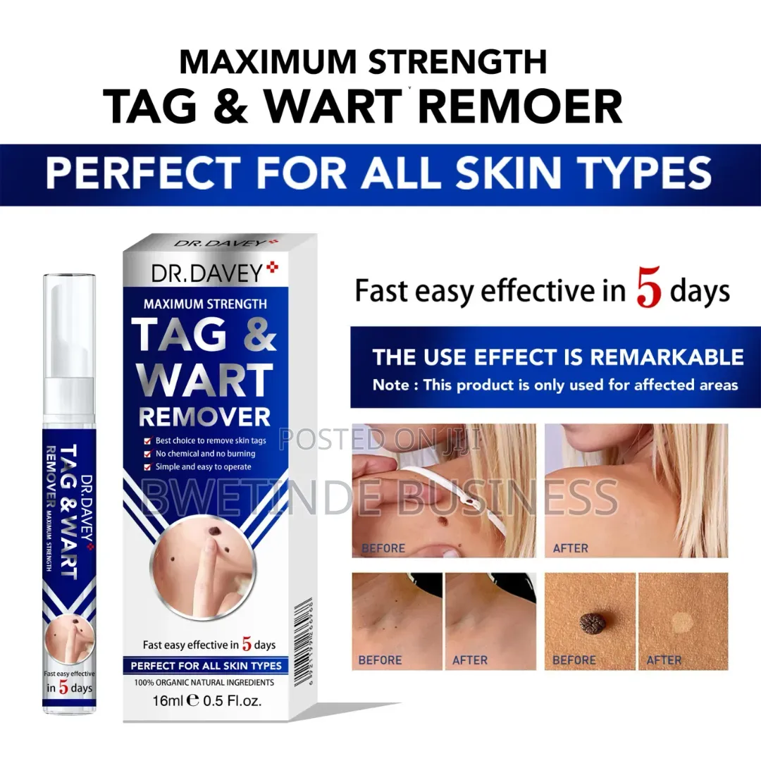 SKIN Tag Wart Remover – Fast Acting Skin Tag Treatment - 16ml