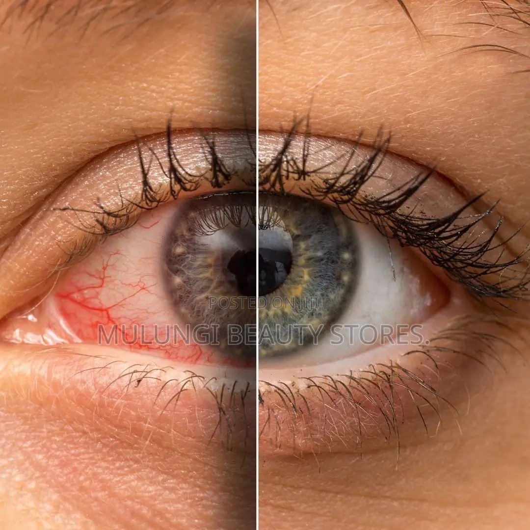 Instant Eye Whitening Drop