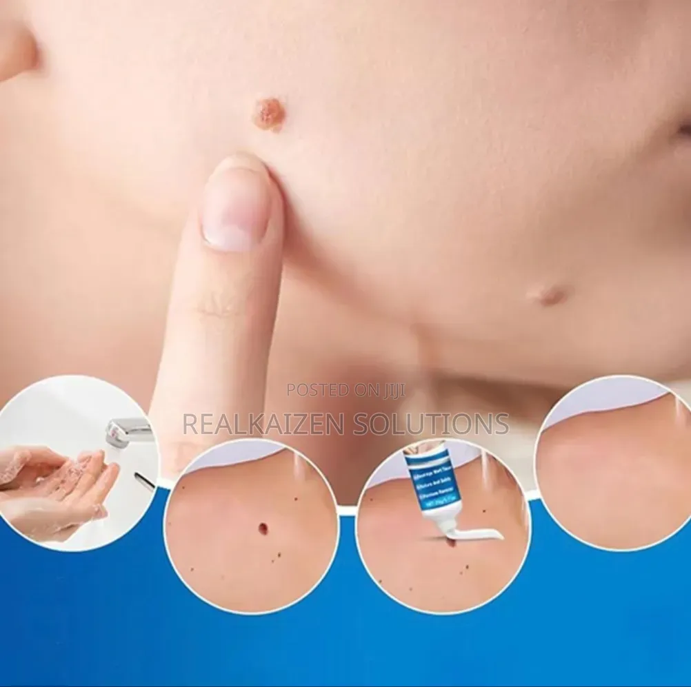 DR DAVEY Wart Tag Remover Solution Convenient Natural Topical Serum