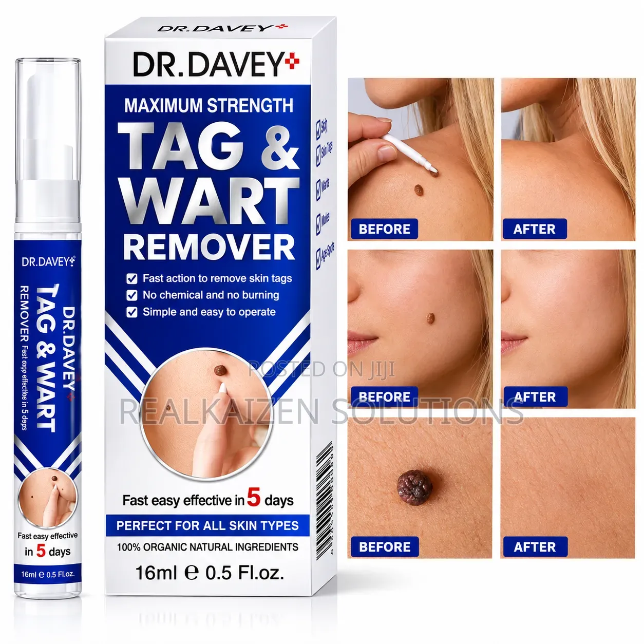 DR DAVEY Wart Tag Remover Solution Convenient Natural Topical Serum