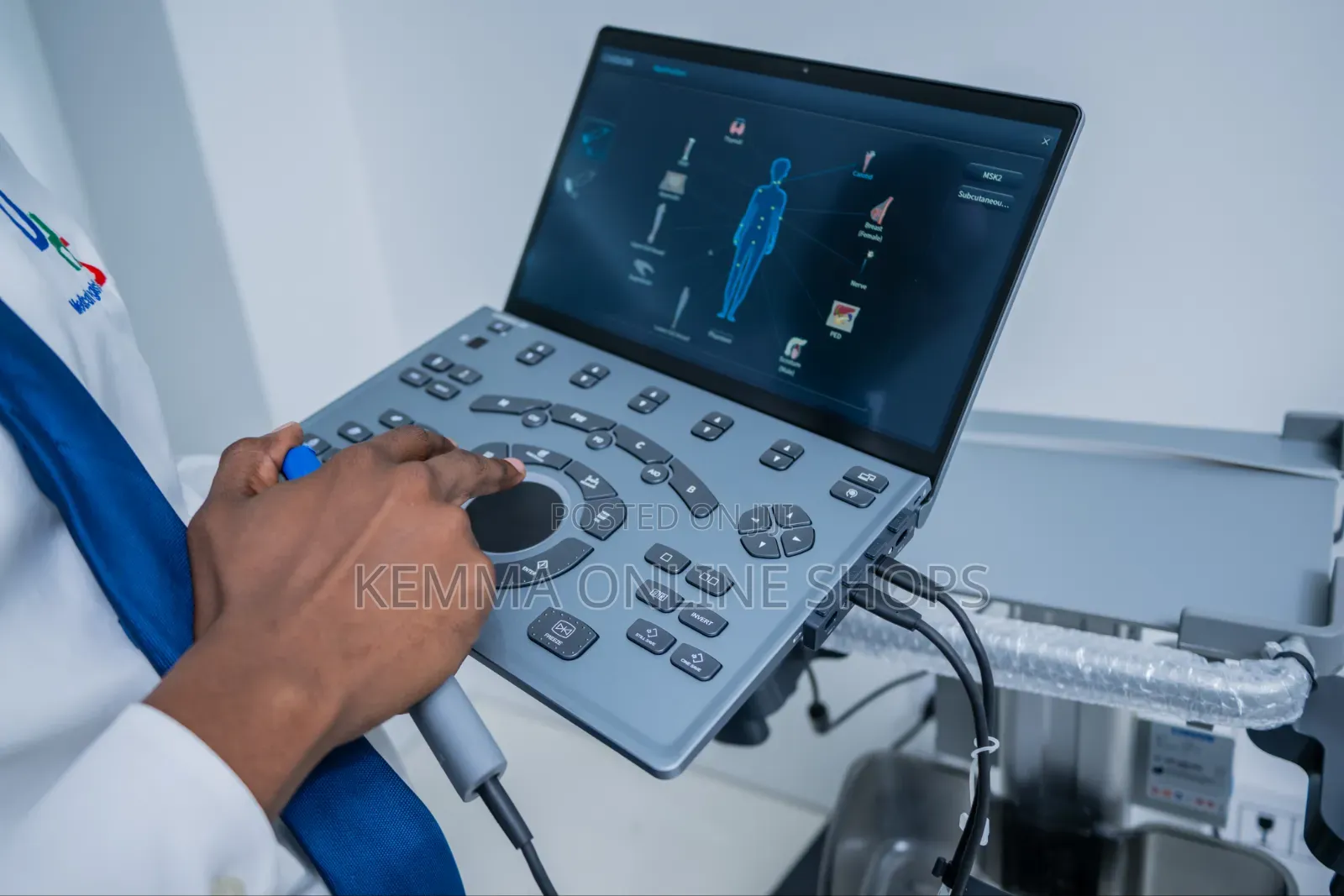 Chison Air Portable Laptop Ultrasound System