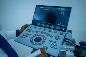 Chison Air Portable Laptop Ultrasound System