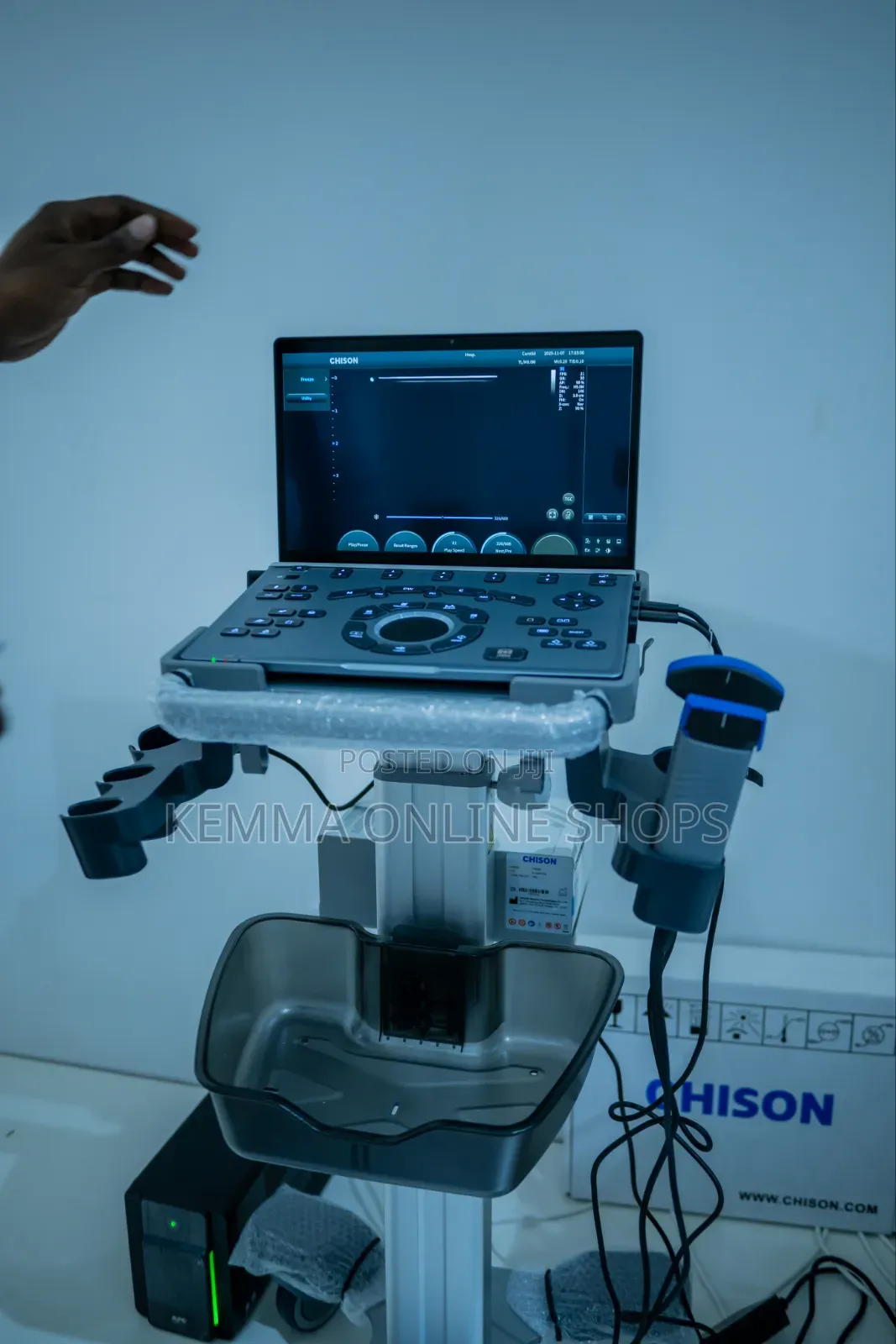 Chison Air Portable Laptop Ultrasound System