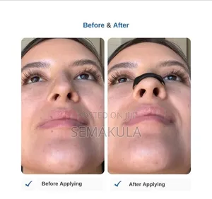 Intake Nasal Dilator / Magnetic Nasal Dilator Set