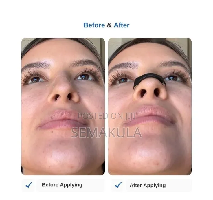 Intake Nasal Dilator / Magnetic Nasal Dilator Set