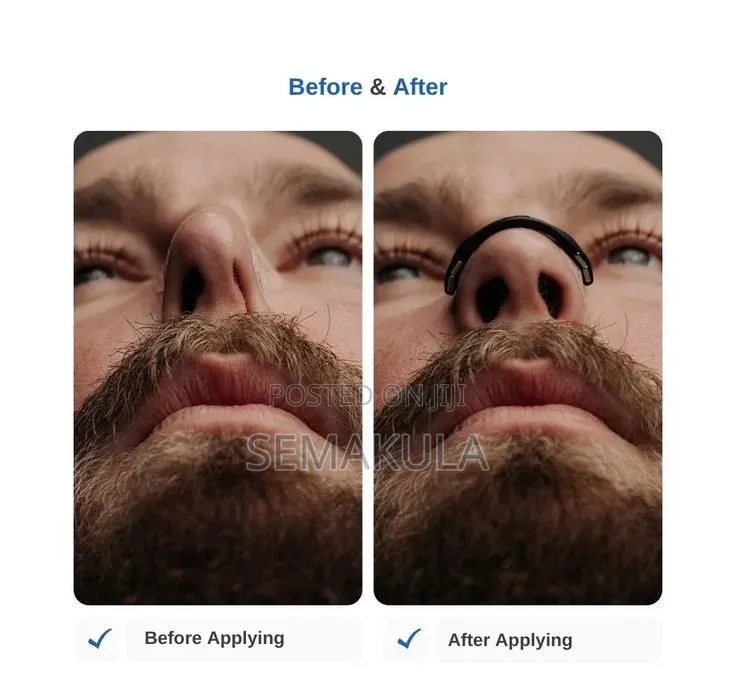 Intake Nasal Dilator / Magnetic Nasal Dilator Set