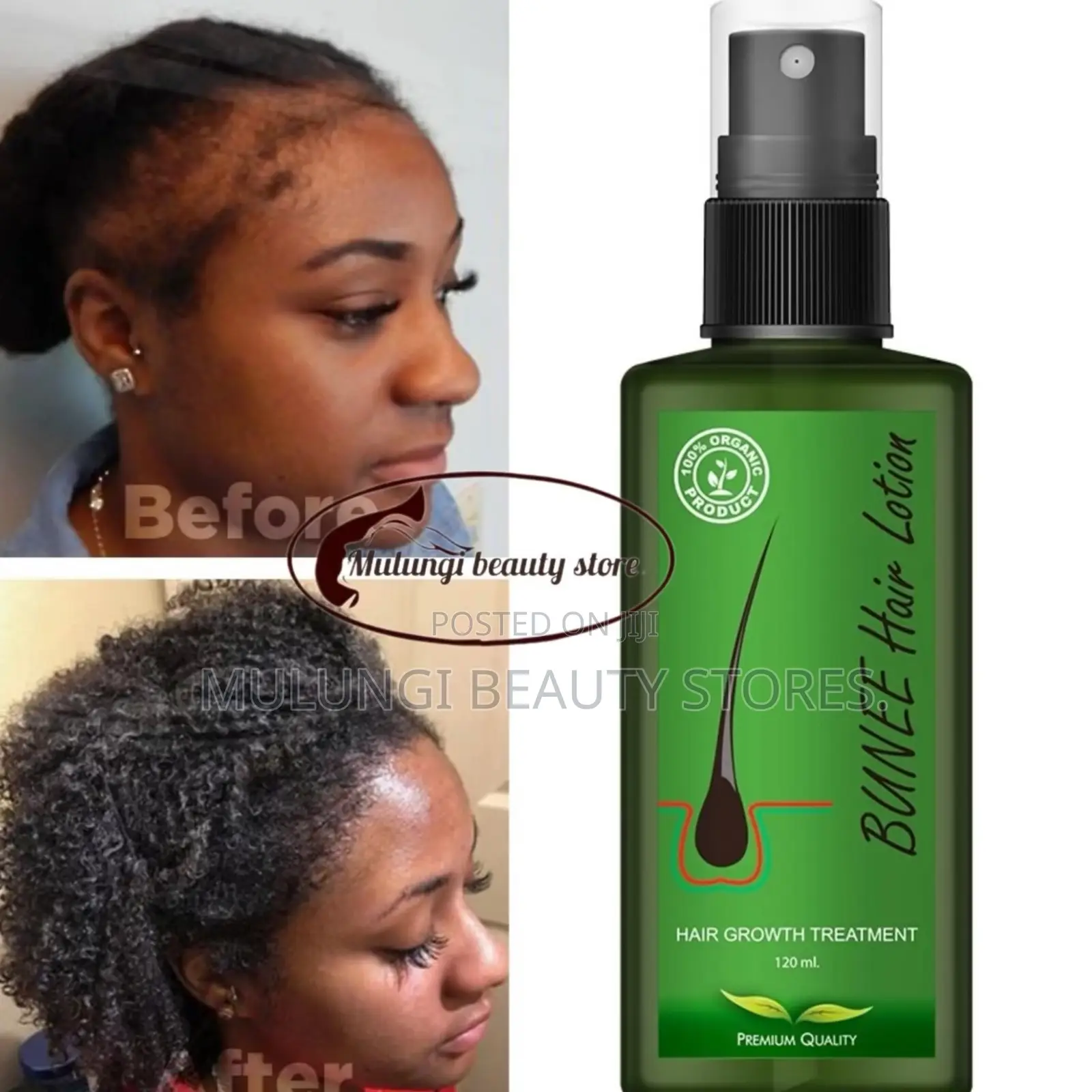 BUNEE 120ml Hair Growth Treatment Spray