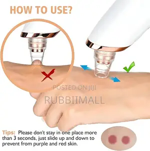Blackhead Remover Vacuum / Electric Pore Cleaner