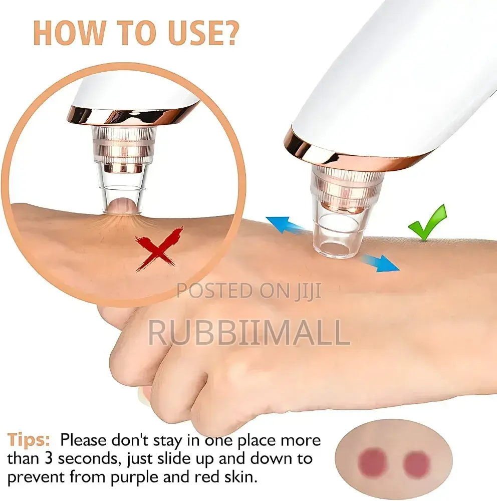 Blackhead Remover Vacuum / Electric Pore Cleaner