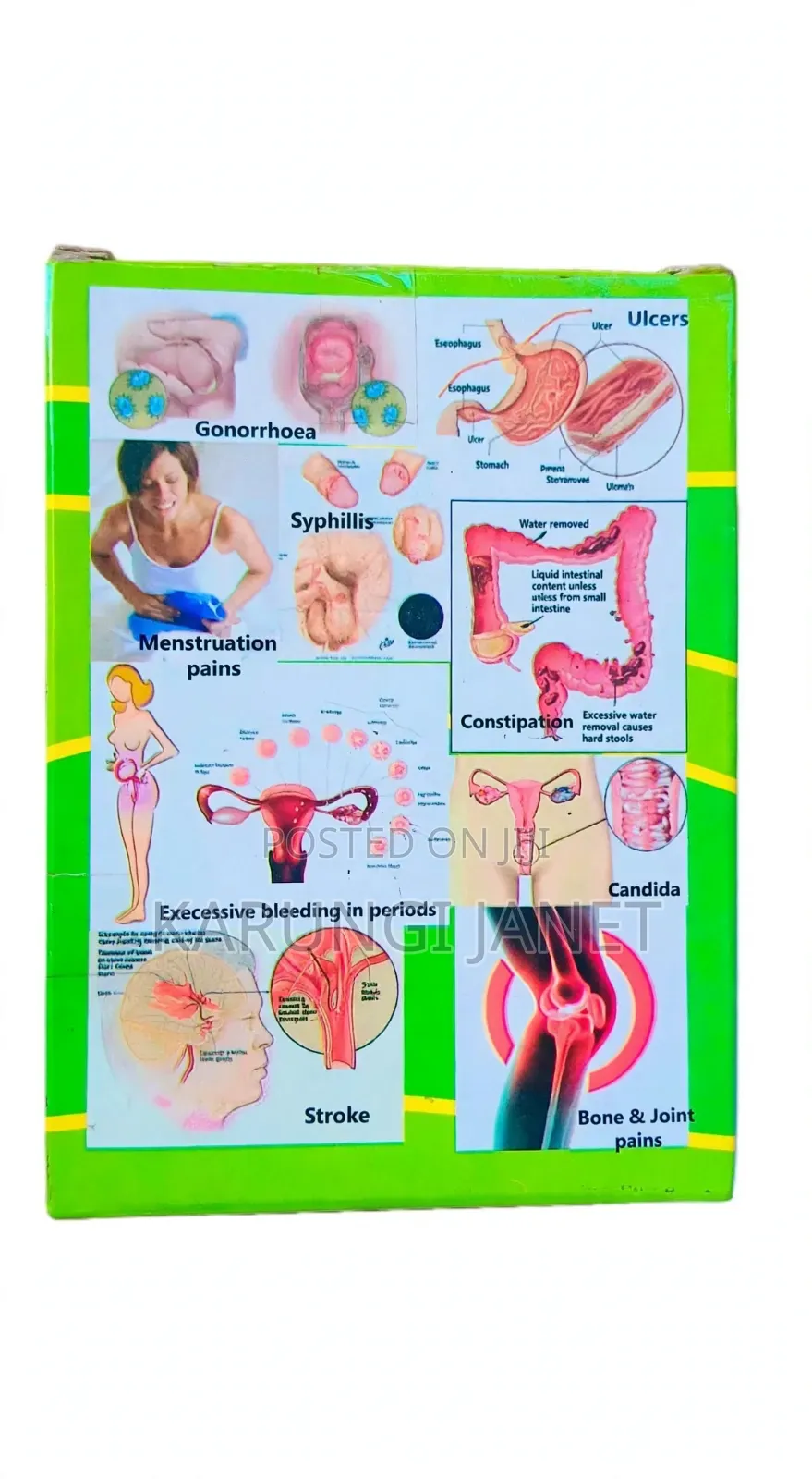 Ryanka 82 Tanzanian Herbal for Ulcers , Infections, Joints and Muscles