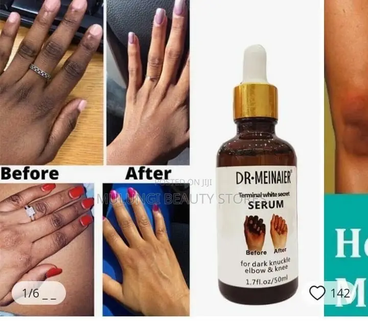 Dr.davey Dark Knuckles Whitening Triple White Serum