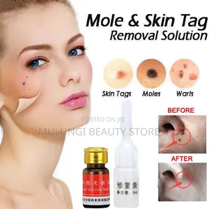 Dr. Luei Speckle Killer & Wart / Skin Tag Remover