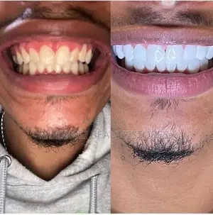 Efero Teeth Whitening Liquid
