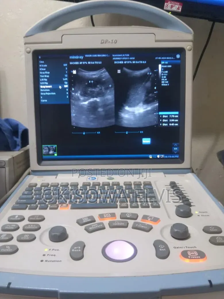 Dp 10 Ultrasound Scan