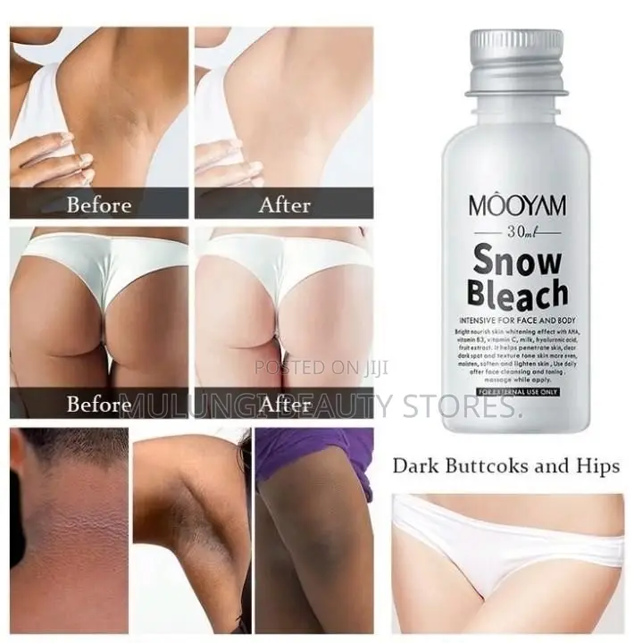Mooyam Snow Bleach, Skin Brightening Sensitive Areas.