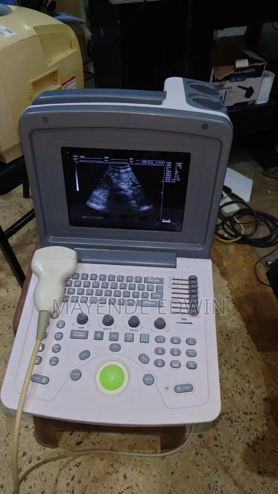 Ultrasound Scan