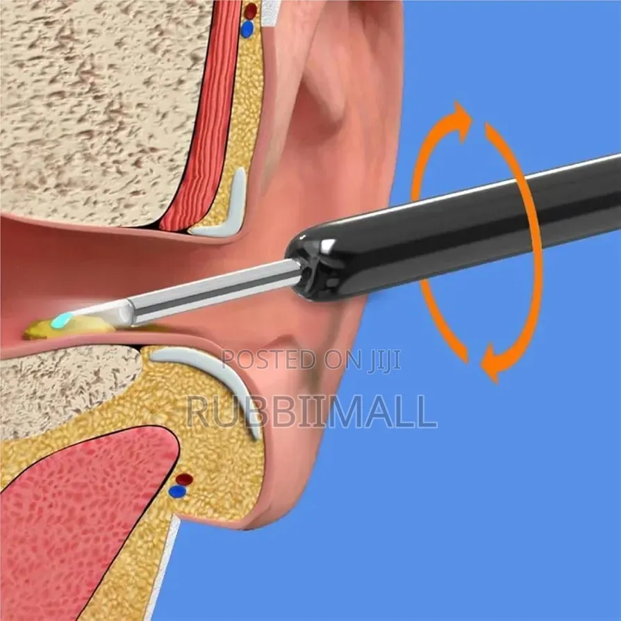 Wireless Visual Earpick / Ear Wax Remover With an HD Camera.
