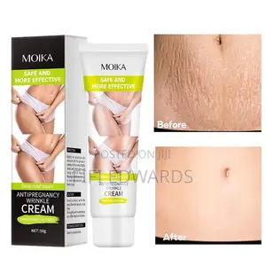 Stretch Marks Cream