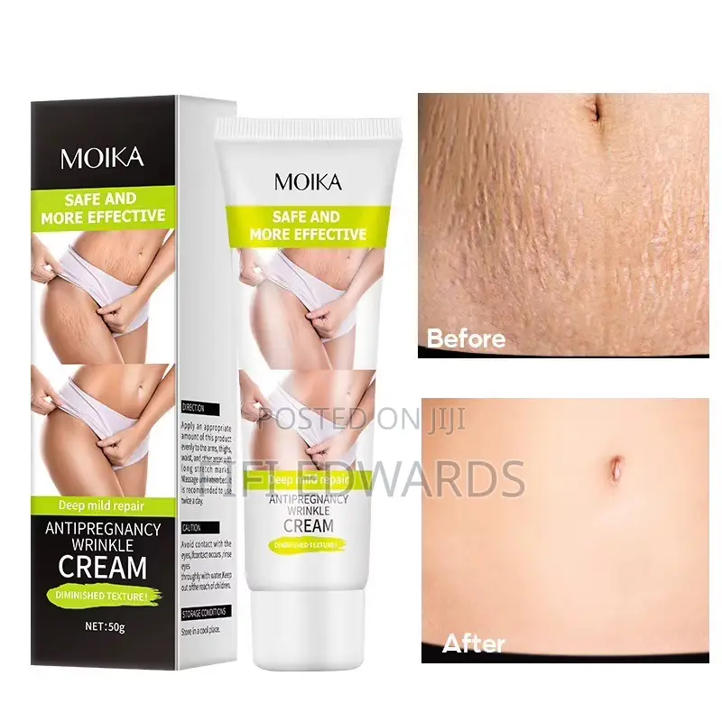 Stretch Marks Cream