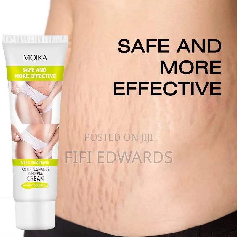 Stretch Marks Cream
