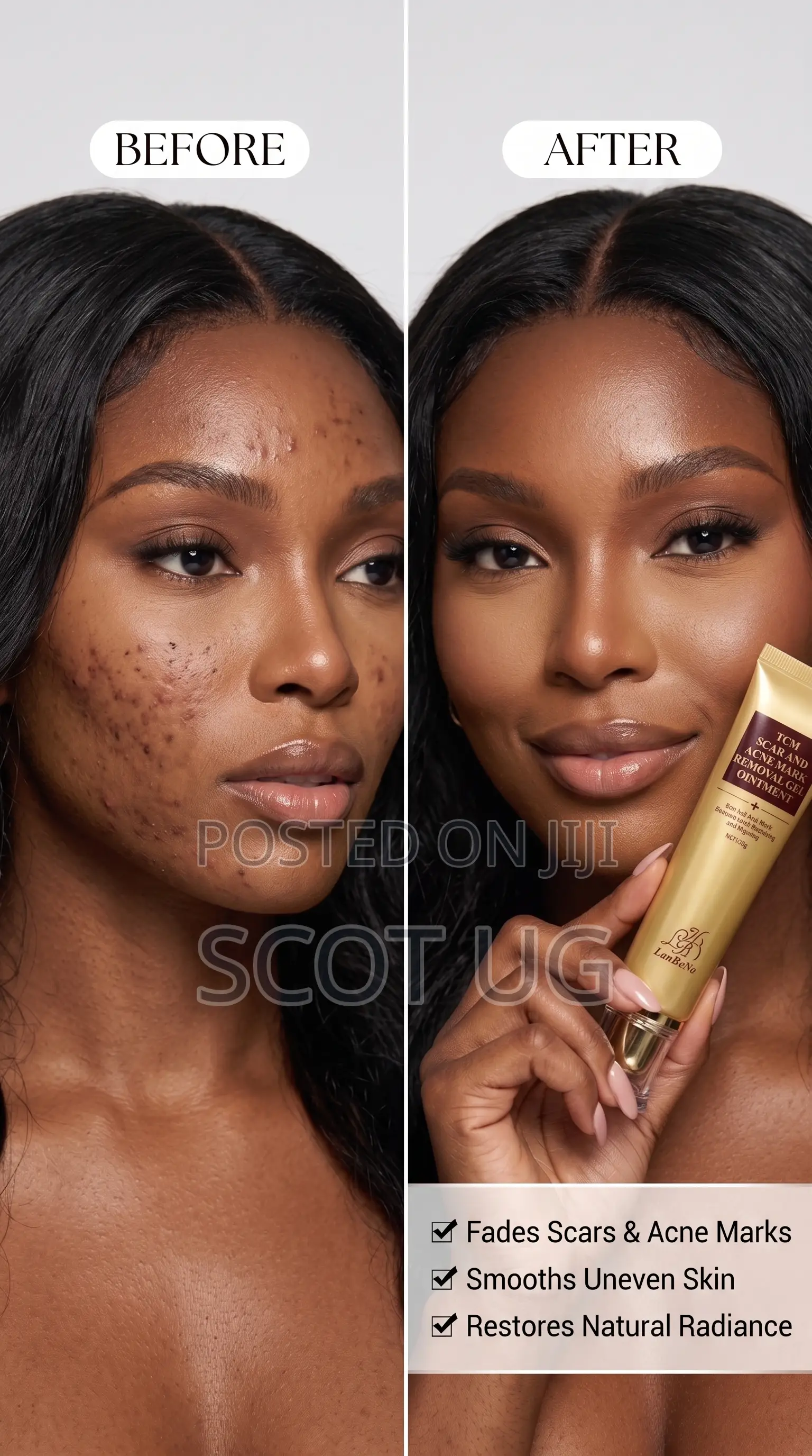 TCM Natural Scar and Mark Removal Cream