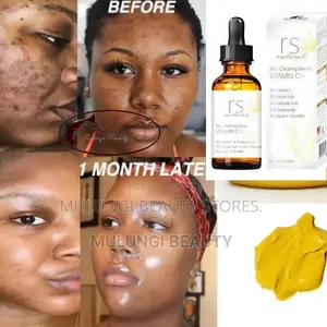 Roushun Naturals Vitamin C+ Skin Clearing Serum (30ml