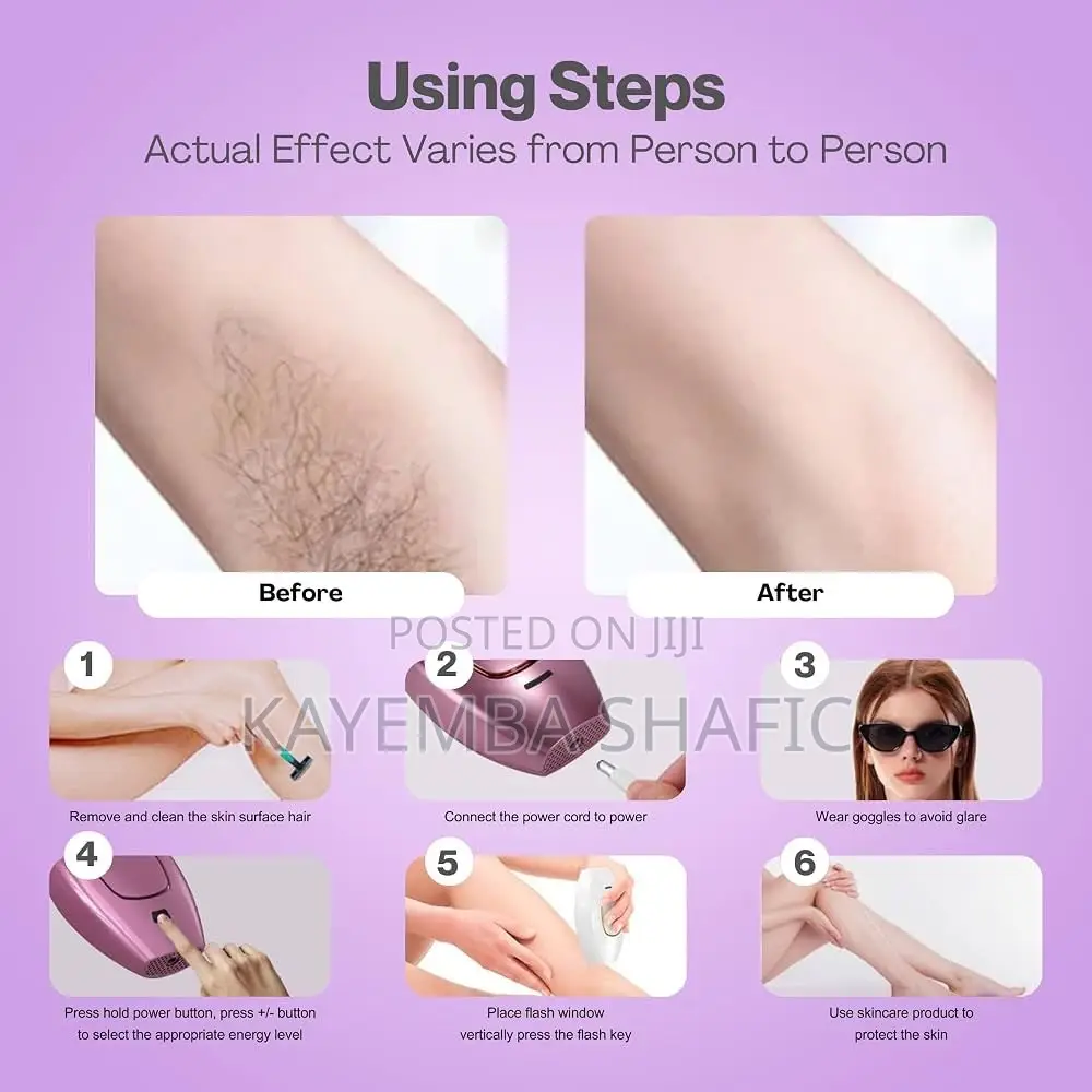 • at-Home IPL Laser Hair Removal Device - Permanent Painless Epilator