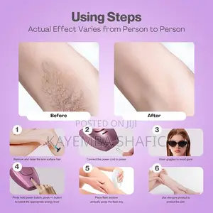 • at-Home IPL Laser Hair Removal Device - Permanent Painless Epilator