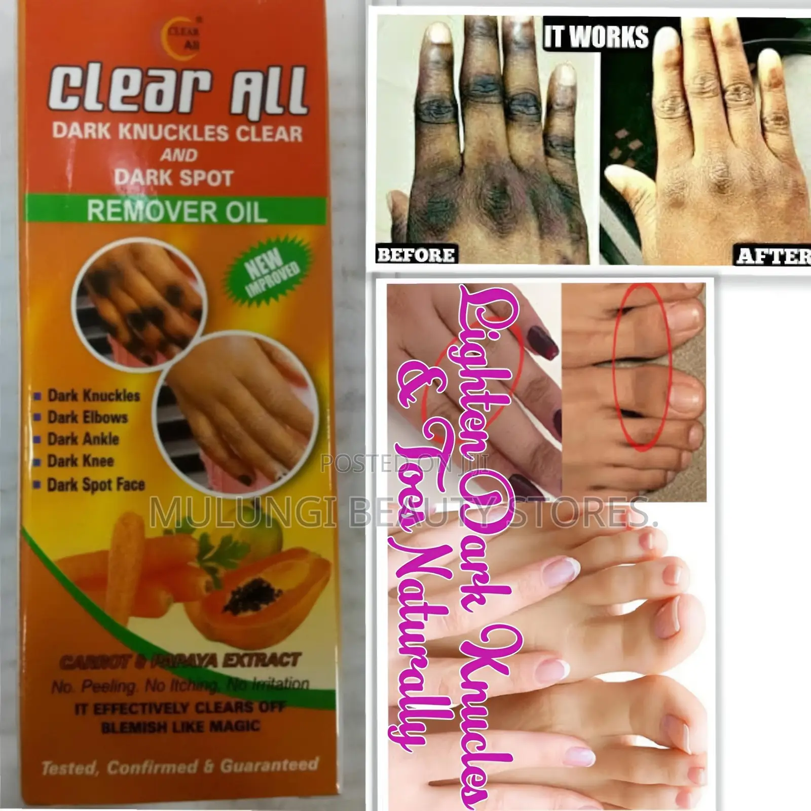 Clear All Dark Knuckles Clear and Dark Spot Remover Oil