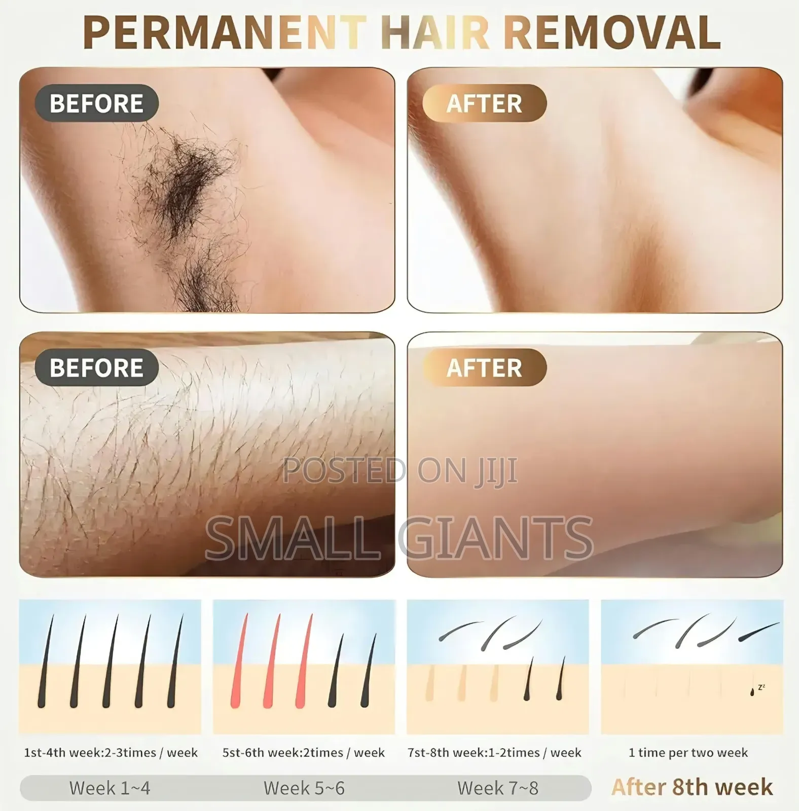 IPL Hair Removal Device for Women & Men