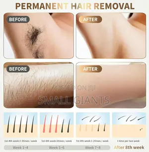 IPL Hair Removal Device for Women & Men