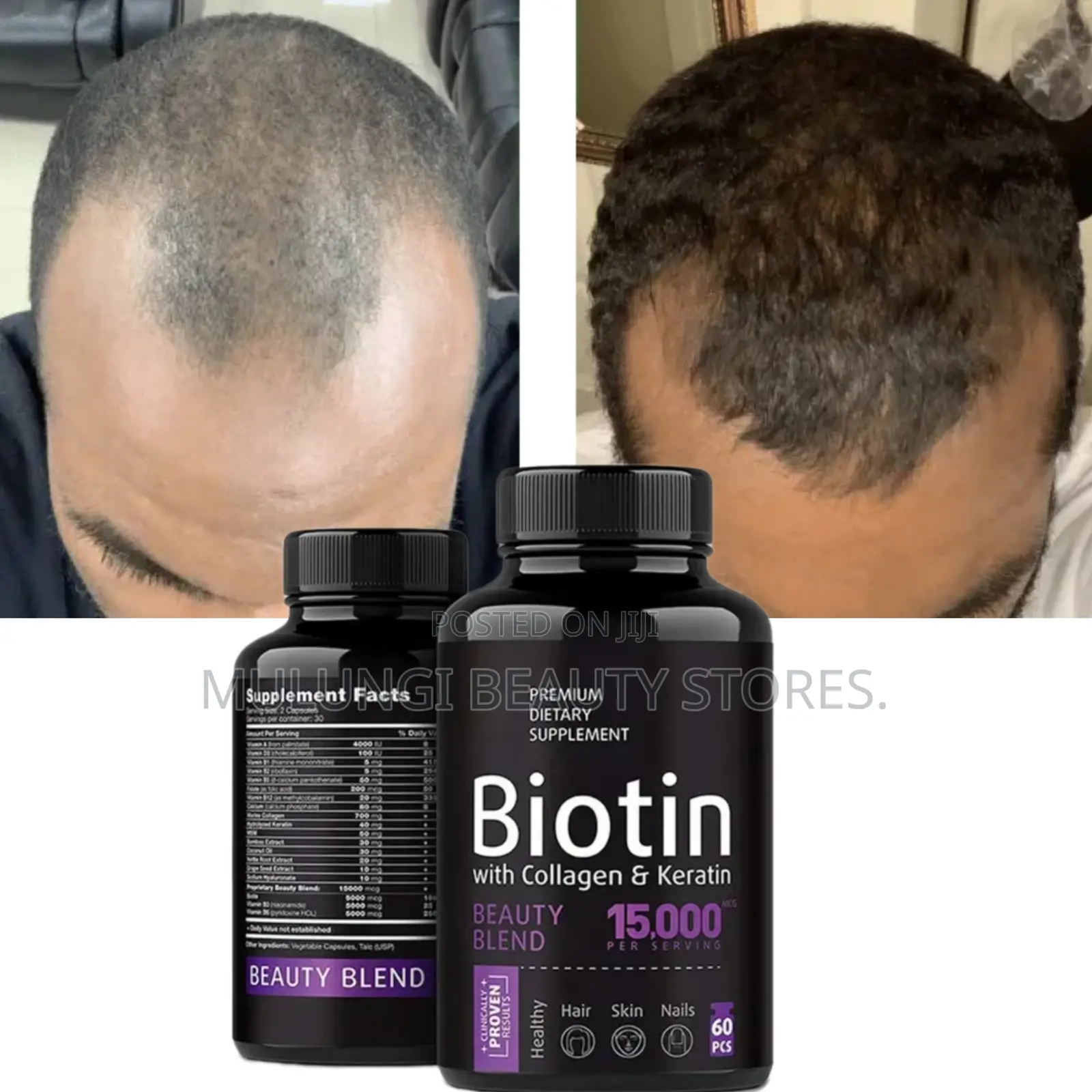 Biotin With Collagen & Keratin Beauty Support Hair, Skin, and Nail