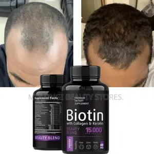 Biotin With Collagen & Keratin Beauty Support Hair, Skin, and Nail