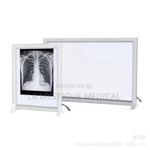 Led X-Ray Film Veiwer
