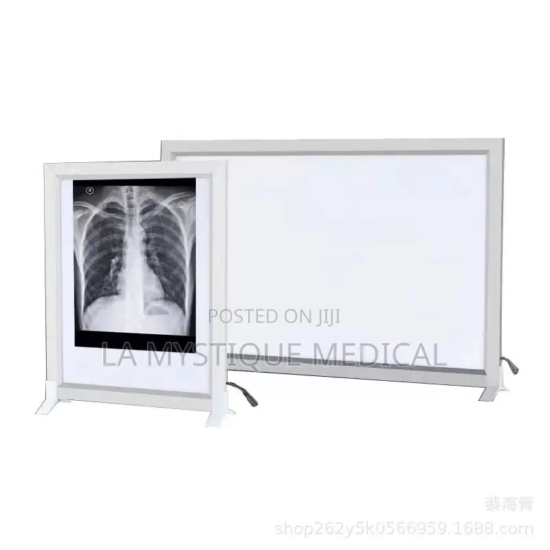 Led X-Ray Film Veiwer