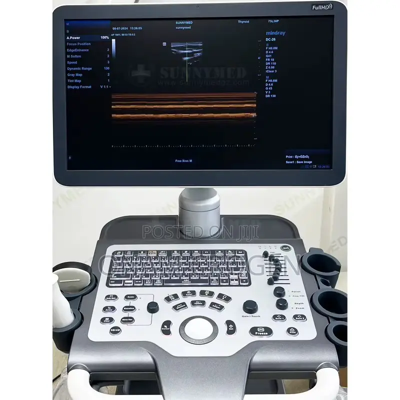 Mindray Dc 30 Full HD Ultrasound Machine