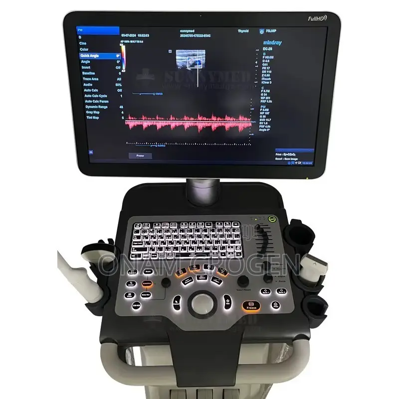 Mindray Dc 30 Full HD Ultrasound Machine