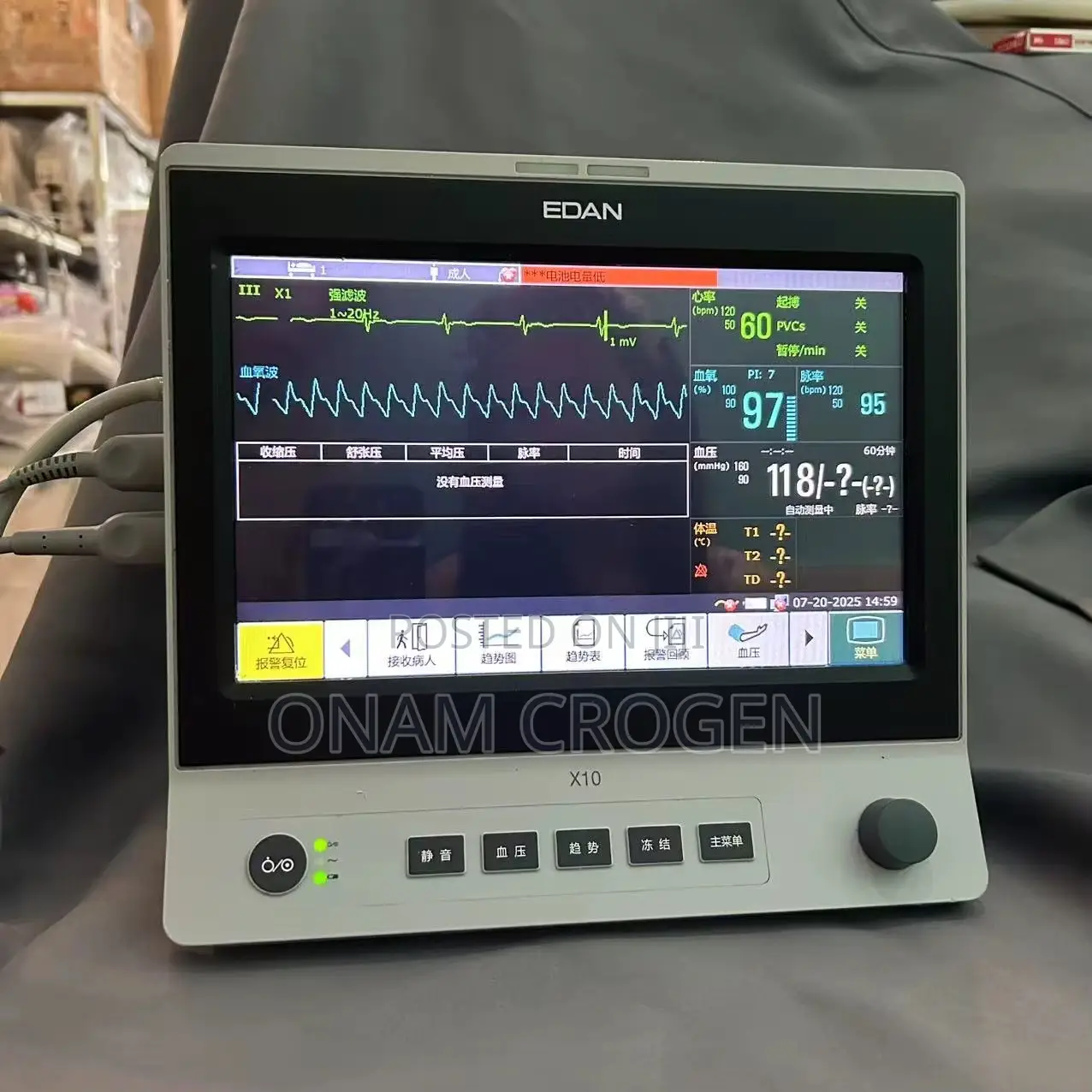 Edan Patient Monitor X10