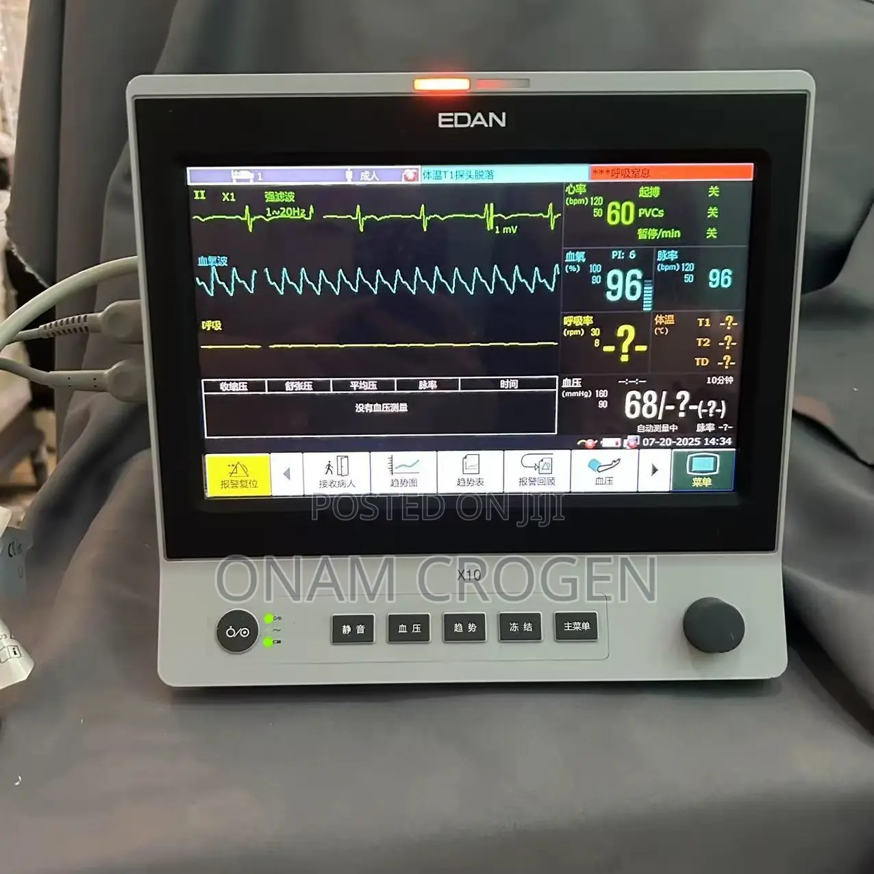 Edan Patient Monitor X10