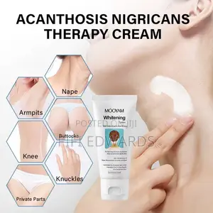 Dark Areas Cream Organic Products Good for Your Toe Skin