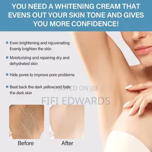 Dark Areas Cream Organic Products Good for Your Toe Skin