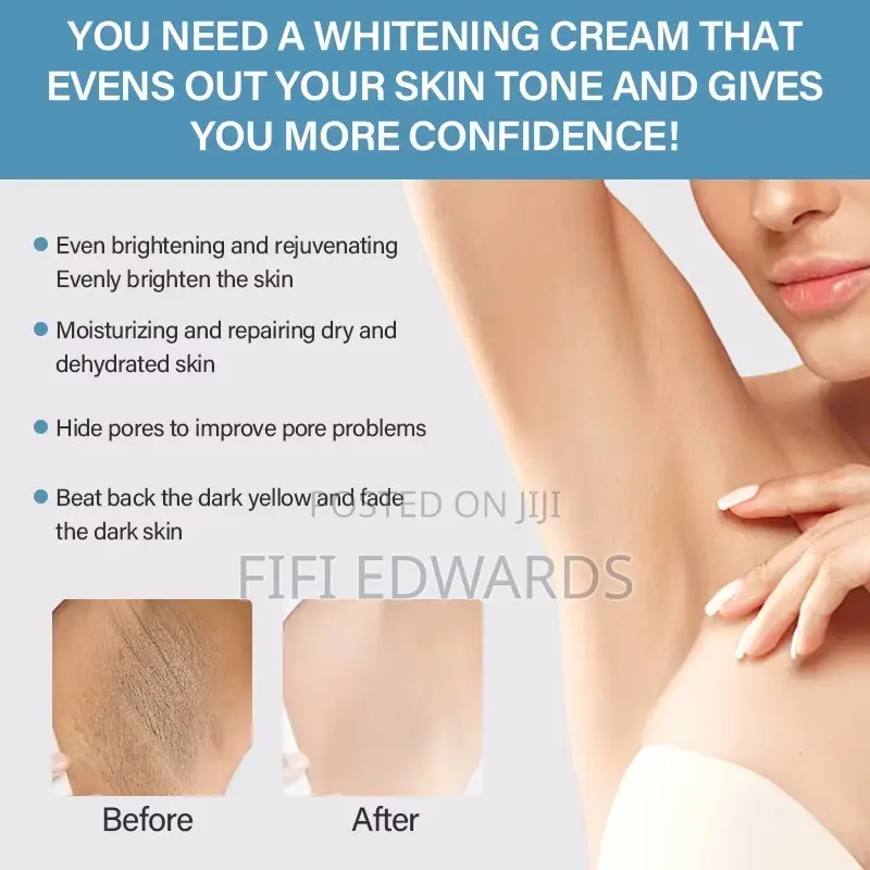 Dark Areas Cream Organic Products Good for Your Toe Skin
