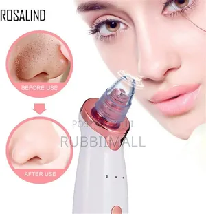 Electric Blackhead Remover Vacuum (Pore Suction Device)