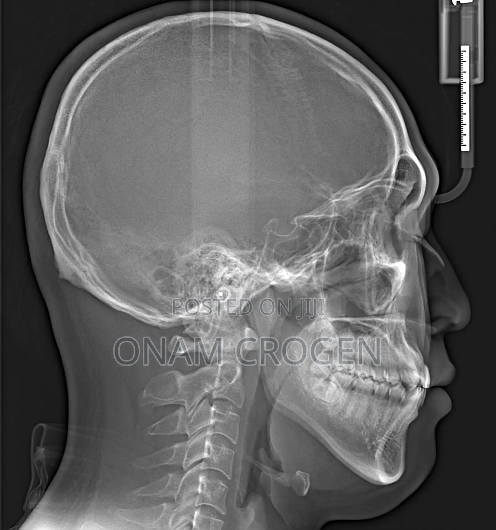 High Precision Panoramic Dental CBCT Scanner