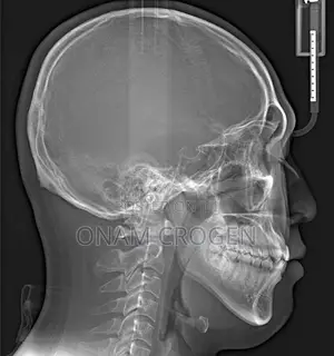 High Precision Panoramic Dental CBCT Scanner