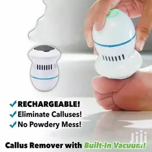 Callus Remover