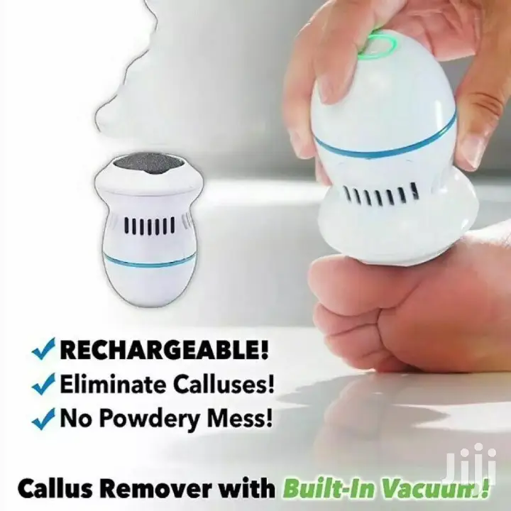 Callus Remover