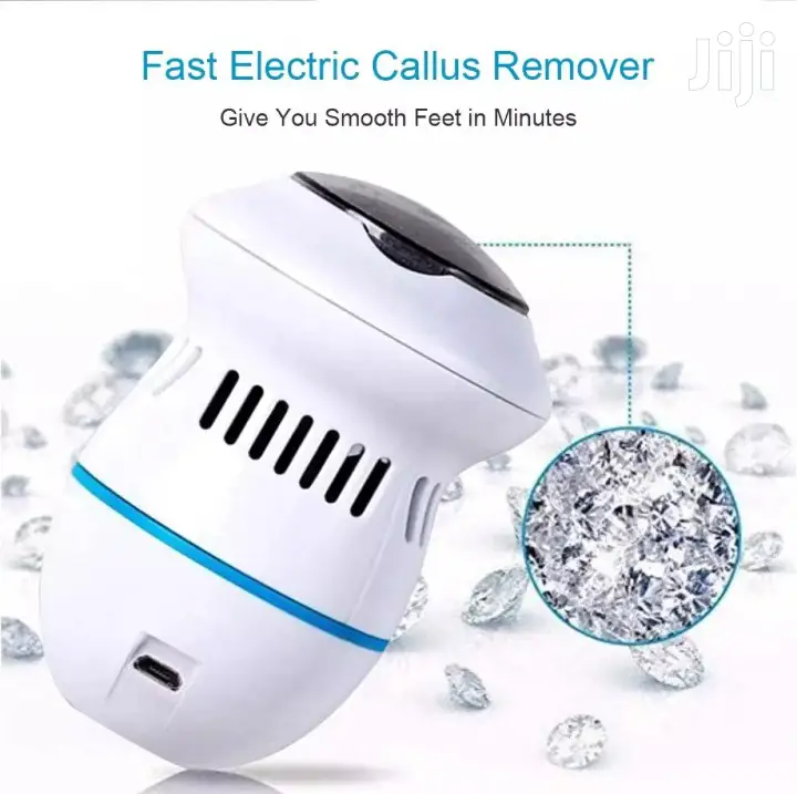 Callus Remover