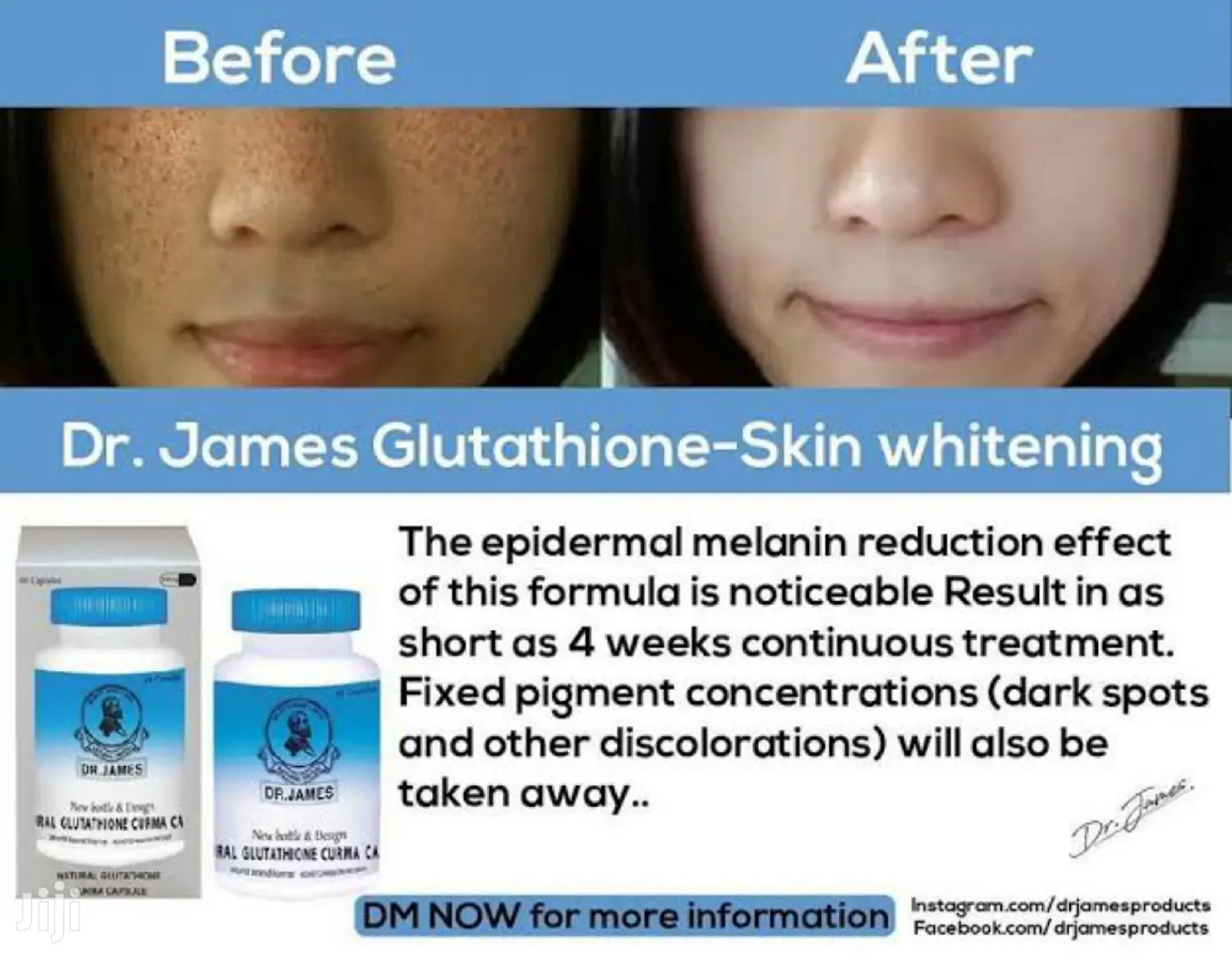 Dr James Skin Whitening Natural Glutathione Lightening Pills